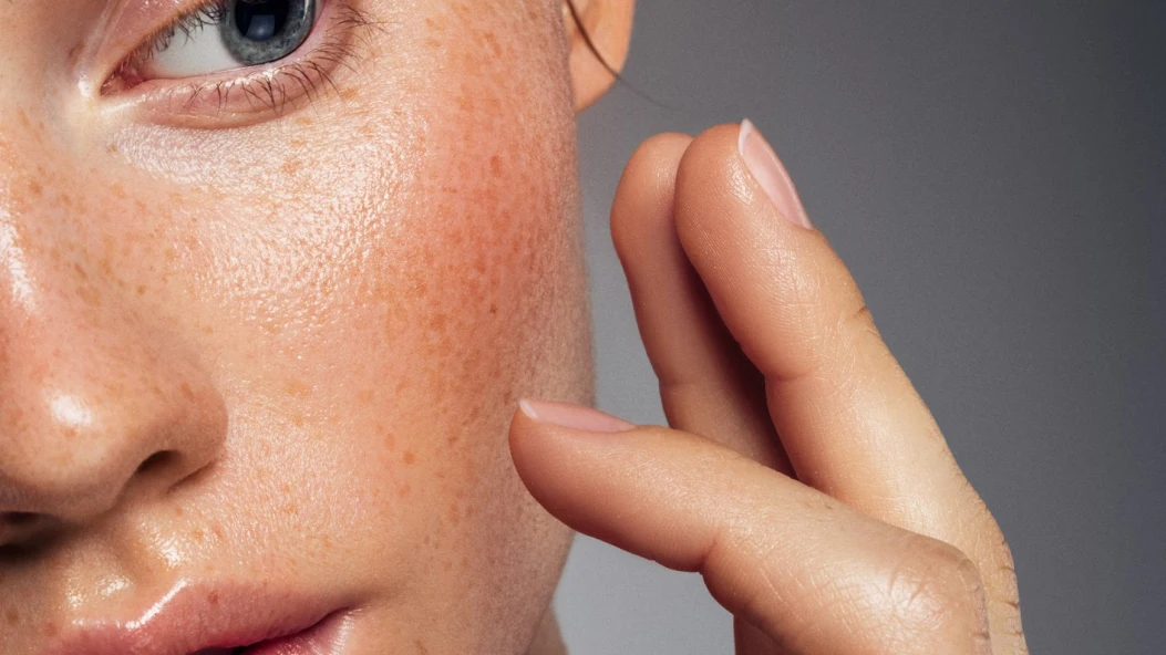 Розацеа чи чутлива шкіра: як зрозуміти причину постійного почервоніння обличчя