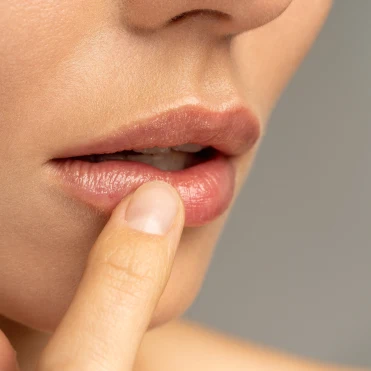 Аптечні бальзами для губ на випадок, коли сухість вийшла з-під контролю